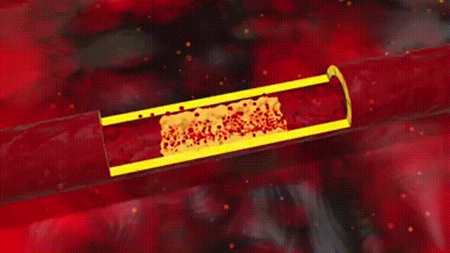 1710062158641358.gif 后 00_00_00-00_00_30.gif