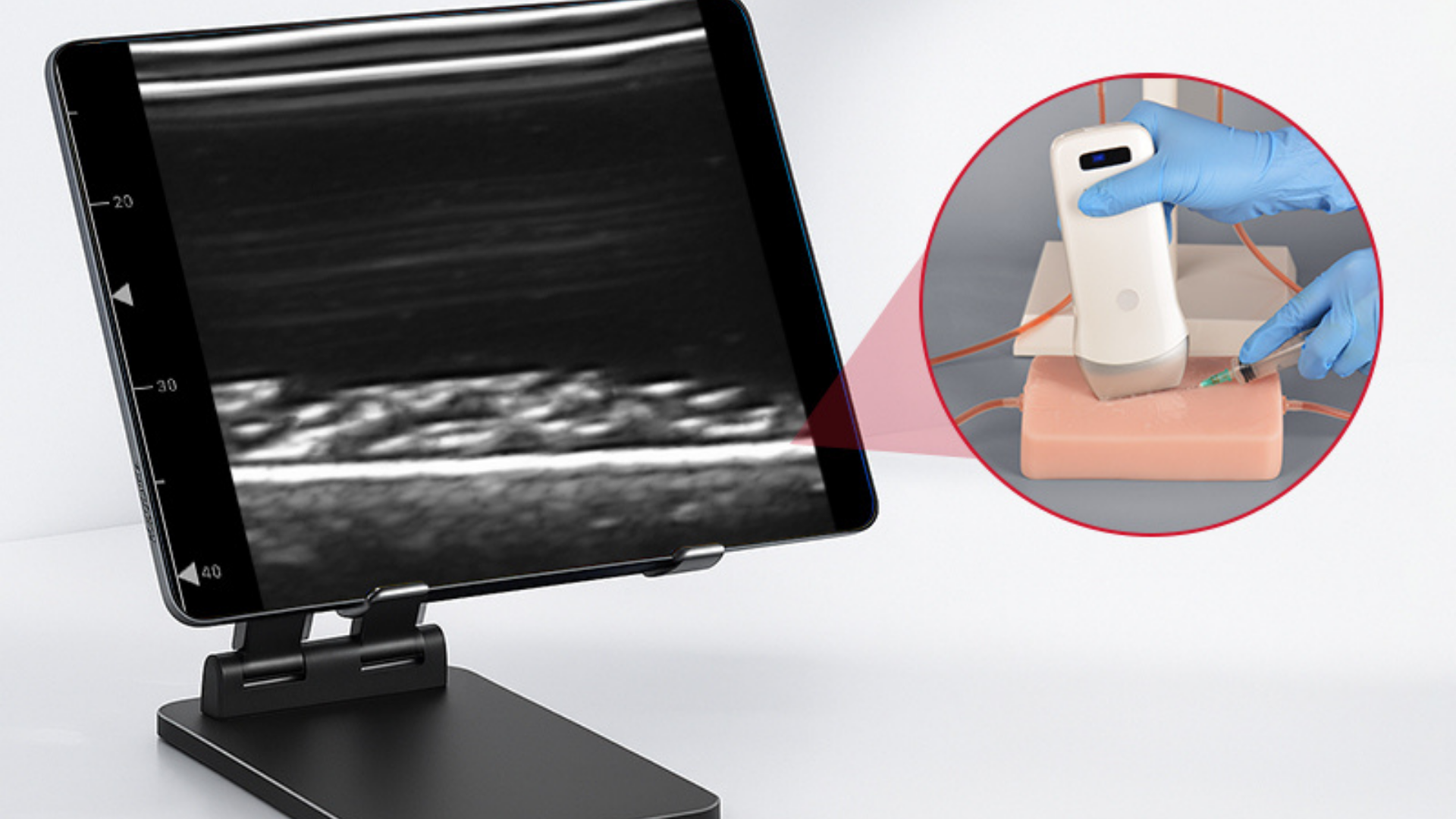 Ultrasound in Vascular Access