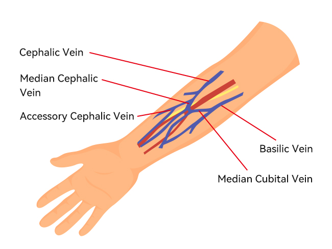 Intravenous Injection Sites on Arm