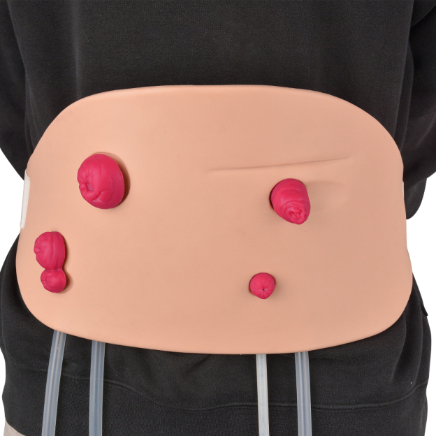 Adjustable ostomy care trainer with 4 types of stomas