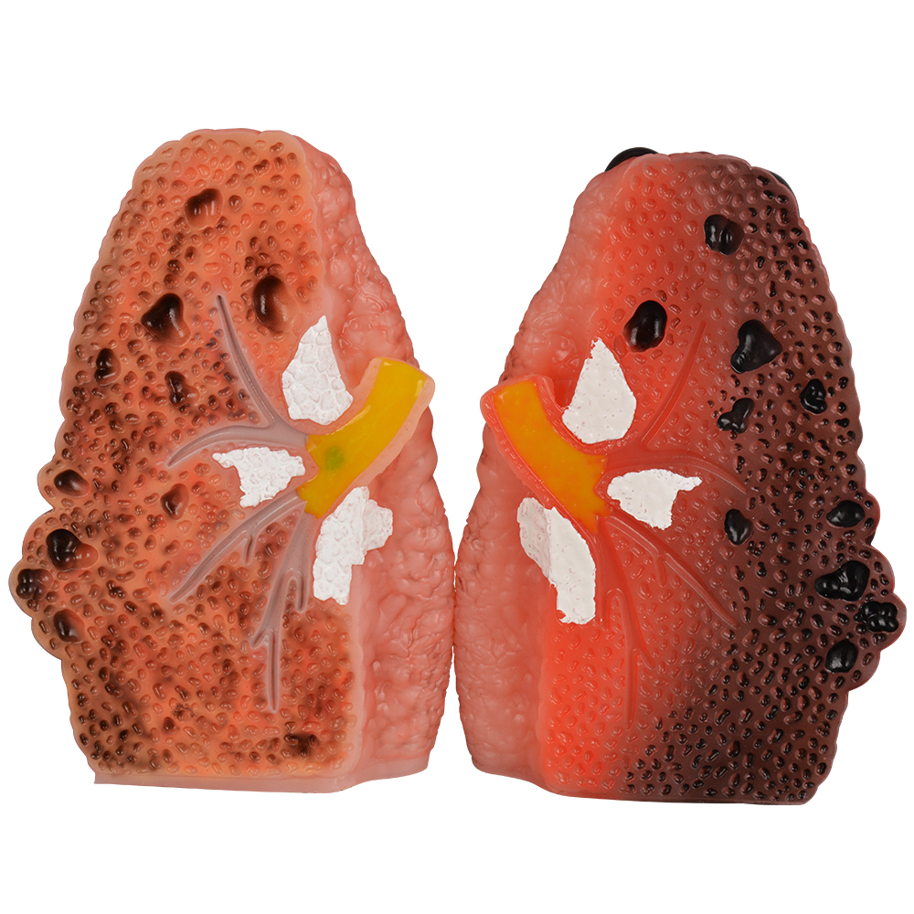 Cough Up Anatomical Lung Model (1 Pair)