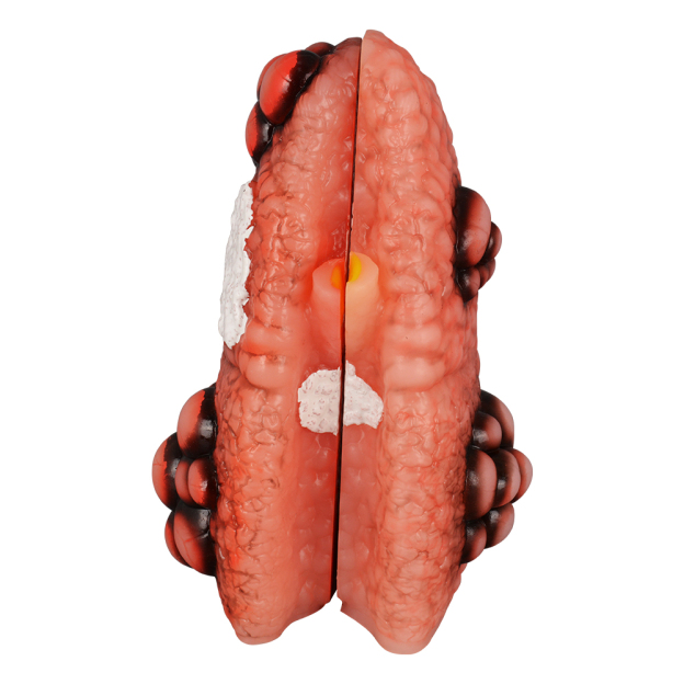 Cough Up Anatomical Lung Model (1 Pair)