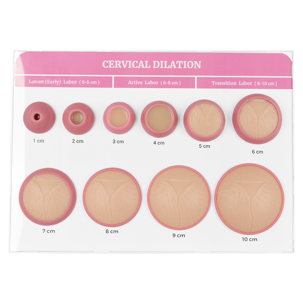 Cervical Effacement and Dilation Model (1–10cm)