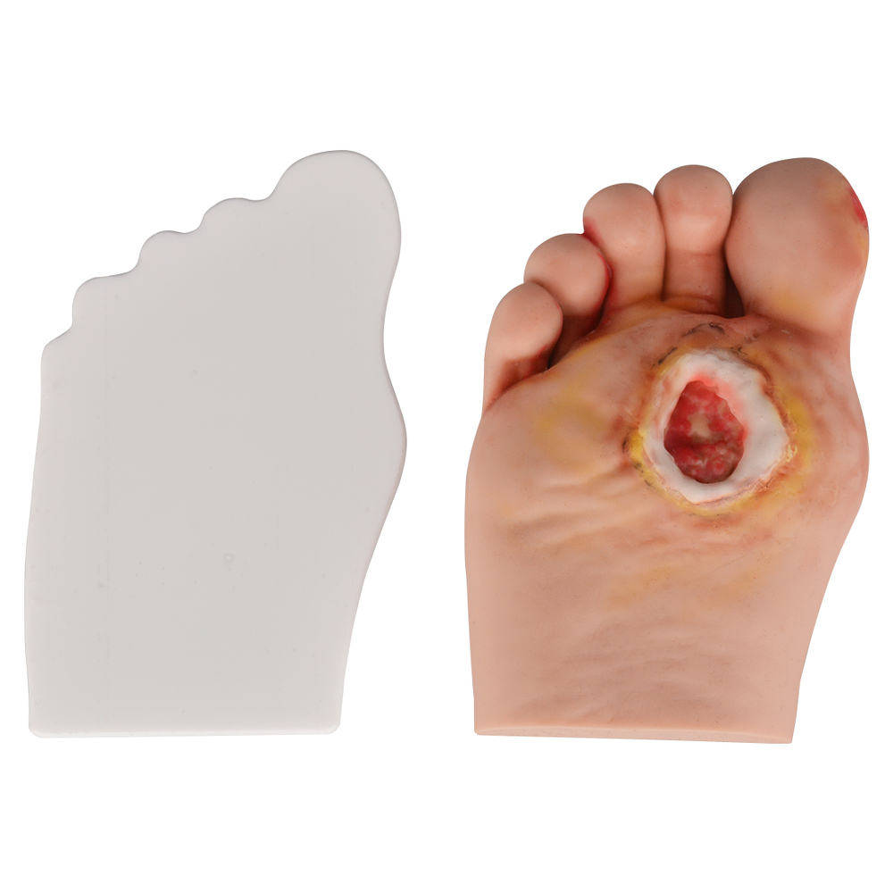 Stage3 Diabetic Foot Model