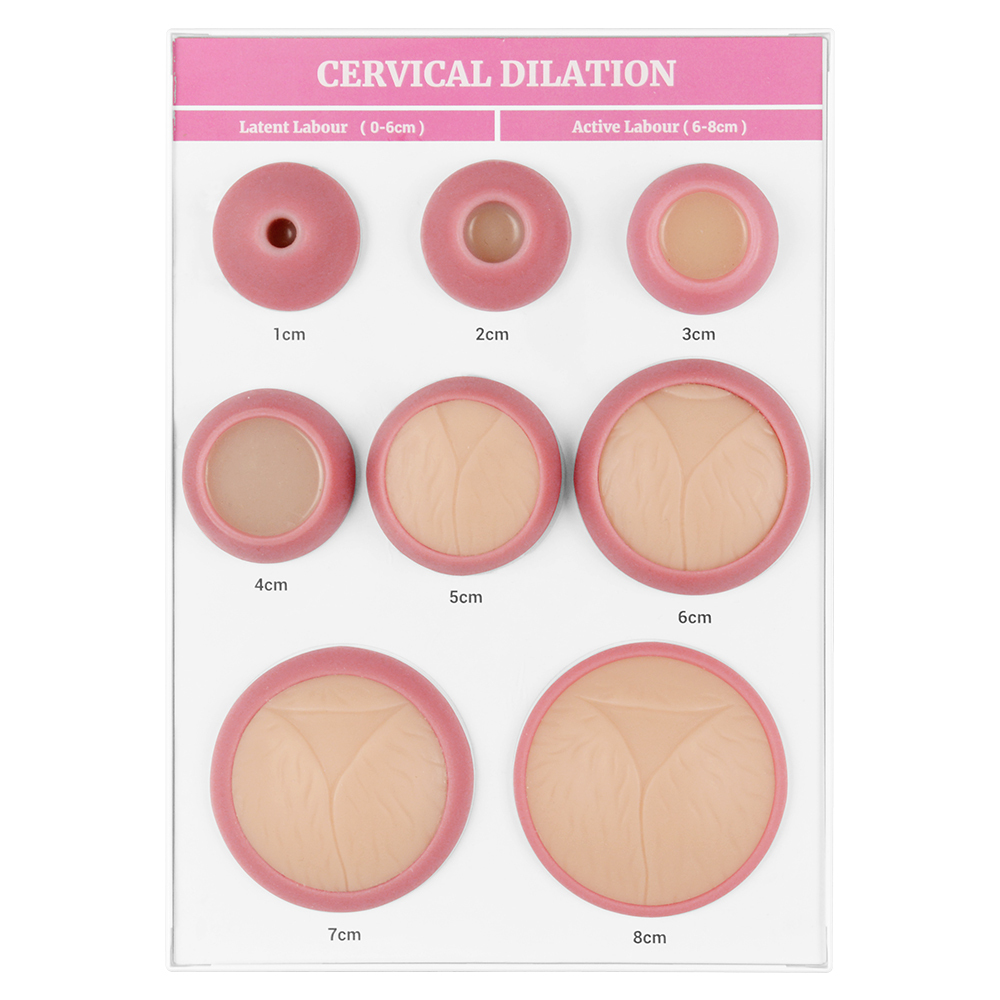 Cervical Dilation Display Model with 1-8cm