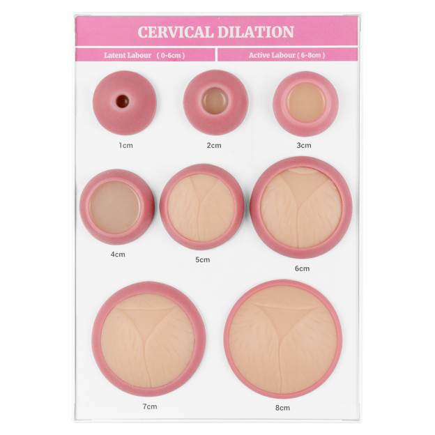 Cervical Dilation Display Model with 1-8cm