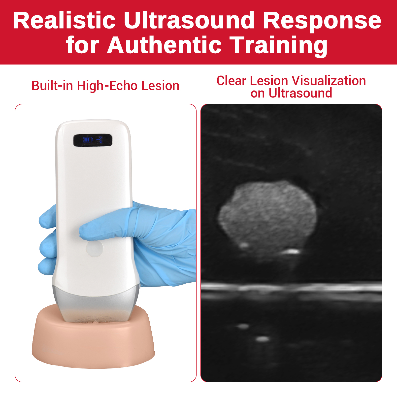 Ultrasound Guided Biopsy Trainer with Hypoechoic Lesion