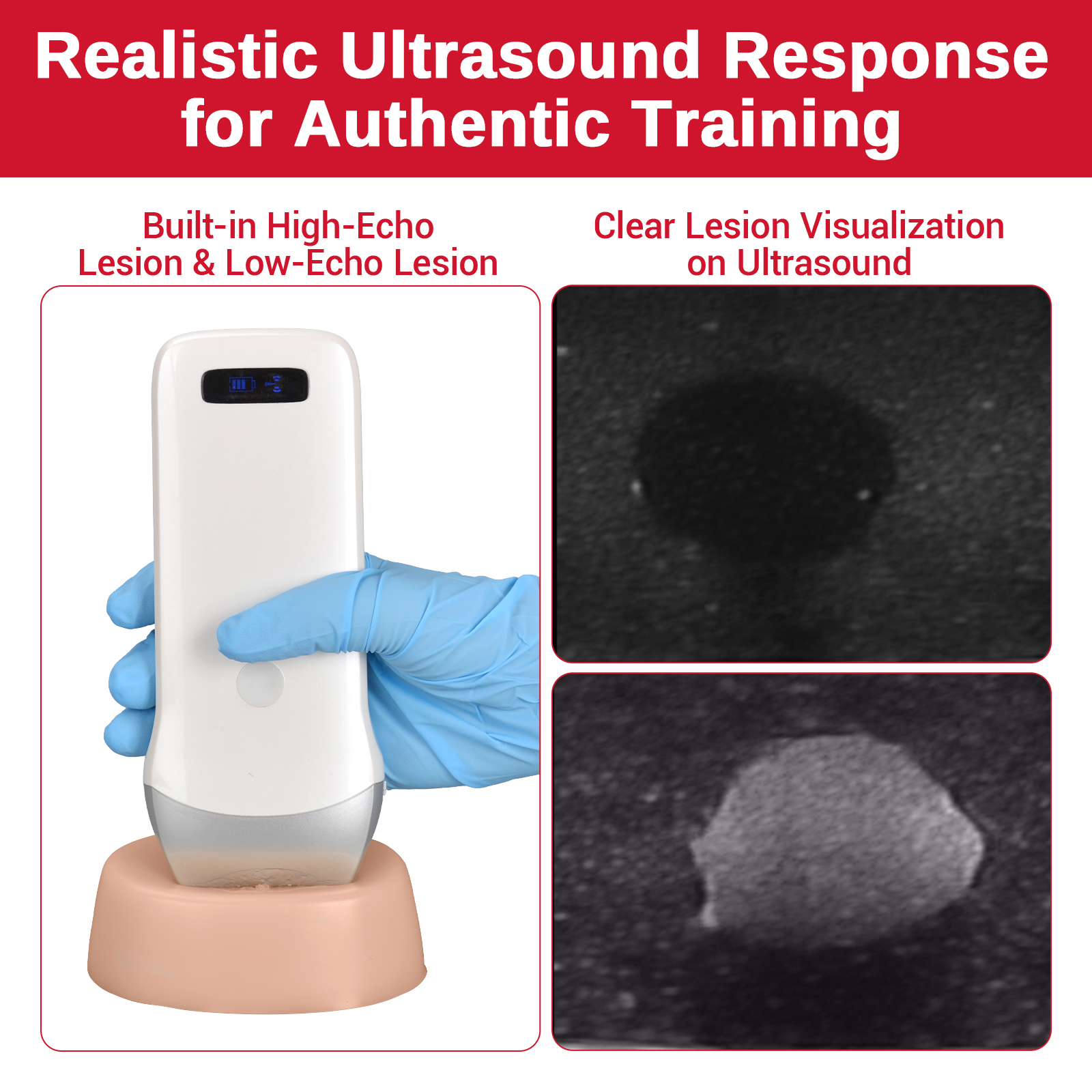 Ultrasound Guided Biopsy Phantom with Dual Lesion Simulation