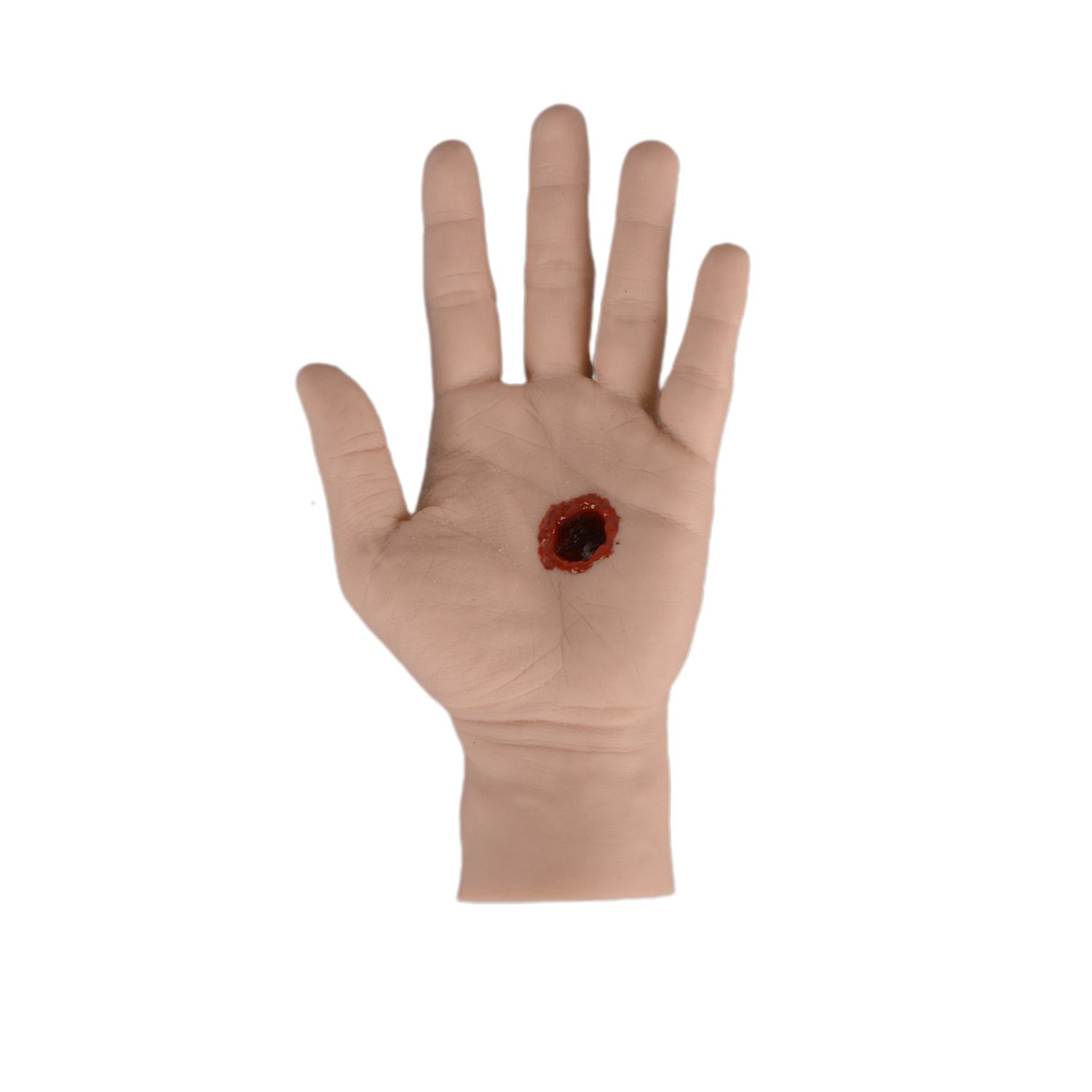 Palm Gunshot Wound Without Bleeding System