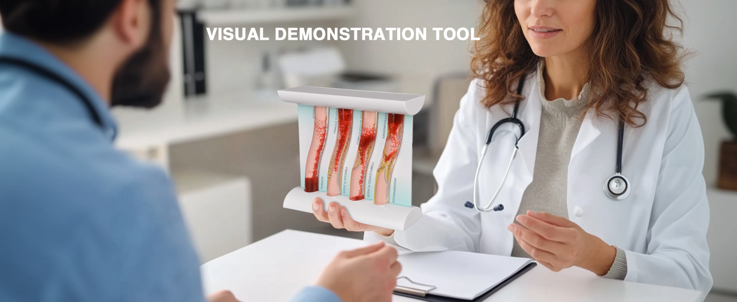Low-Density Lipoprotein LDL Blood Vessel Model