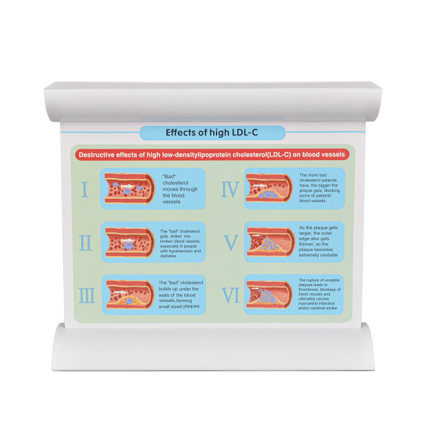 Upgraded Low-Density Lipoprotein LDL Blood Vessel Model