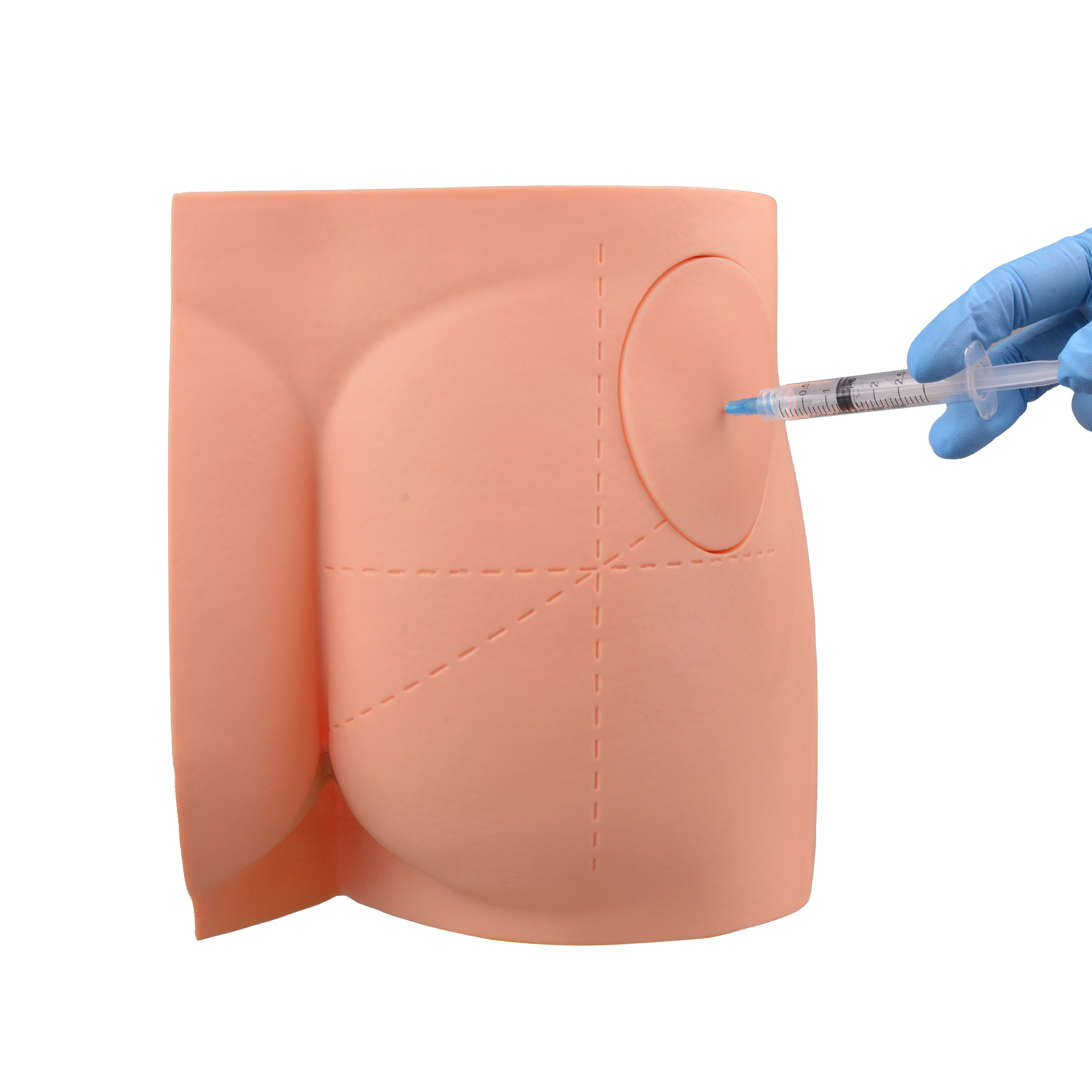 Dorsogluteal Site Injection Lankmark Technique