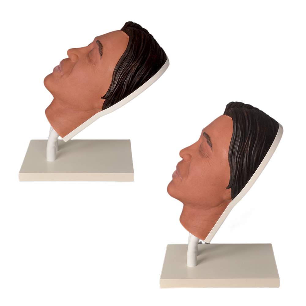 Silicone Face Injection Model For Aesthetic Practice