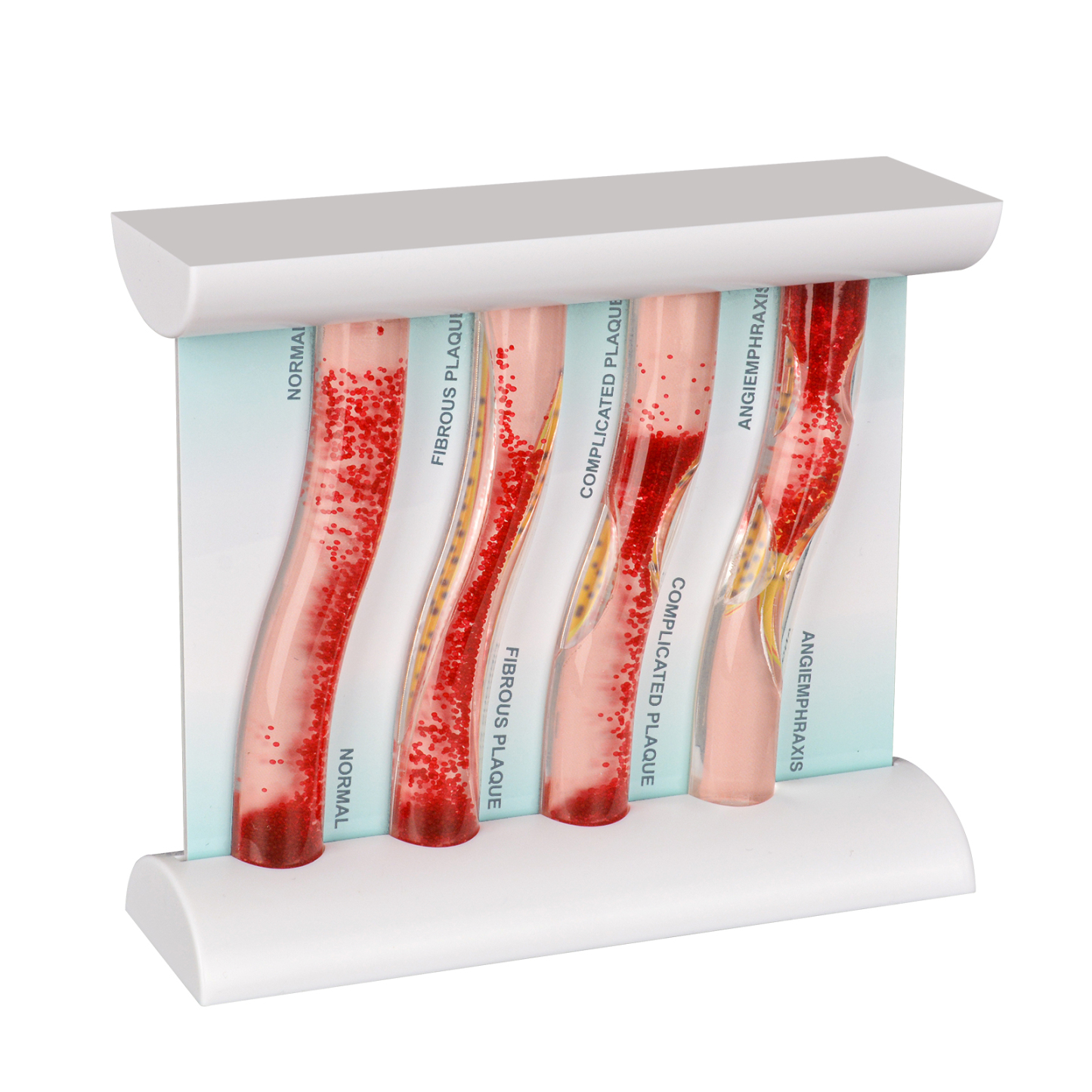 Upgraded Low-Density Lipoprotein LDL Blood Vessel Model