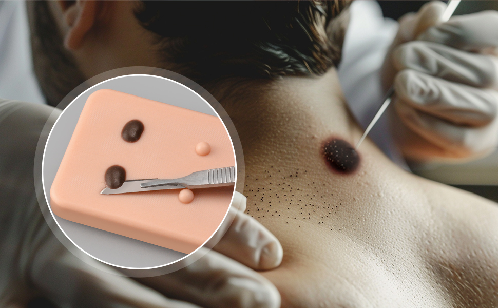 Hands-On Skin Lesion Removal Practice Pad