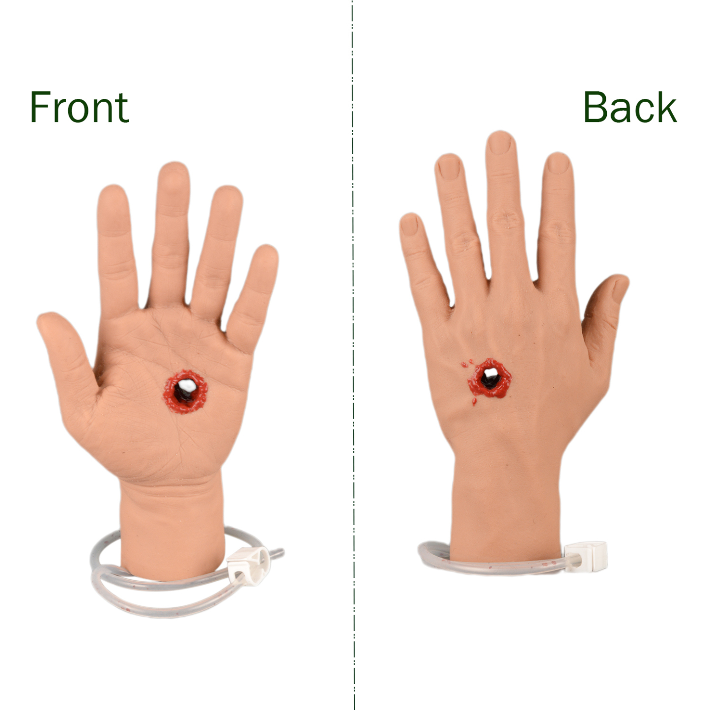 The Front & Back of Gunshot Wound Palm
