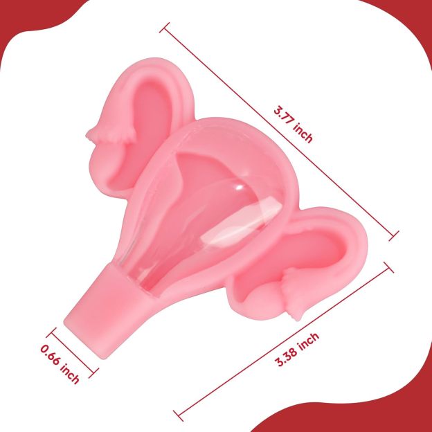 3D IUD Training Model