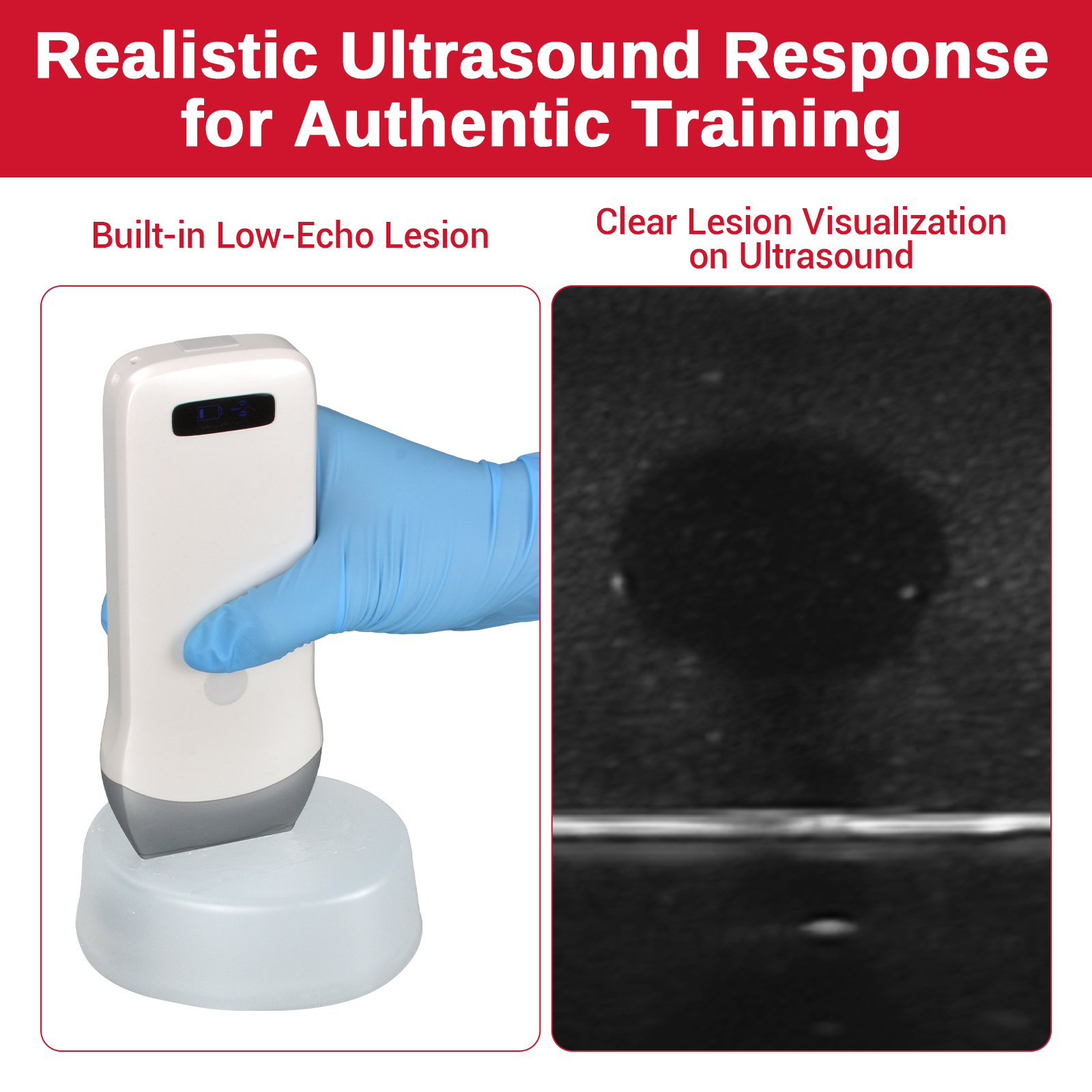 Transparent Ultrasound Guided Biopsy Trainer with Hypoechoic Lesion