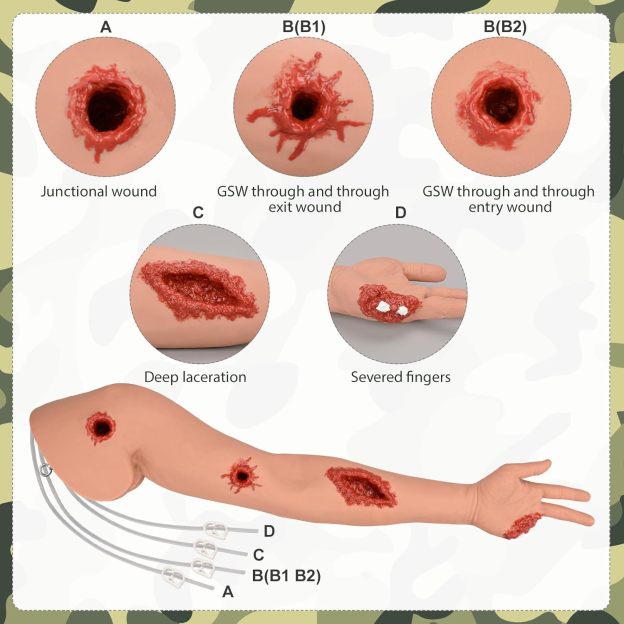 Four Types of Traumatic Wounds on Training Arm