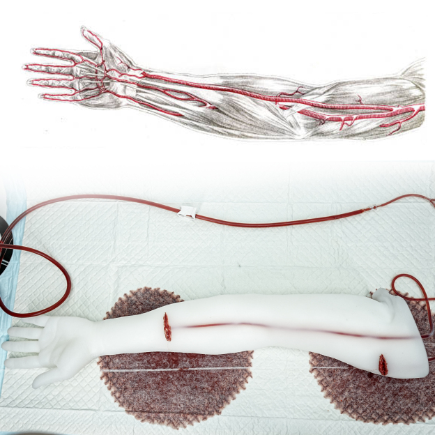 Visible Blood Flow Through Transparent Silicone Arm