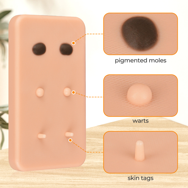 Skin Lesion Removal Training Model