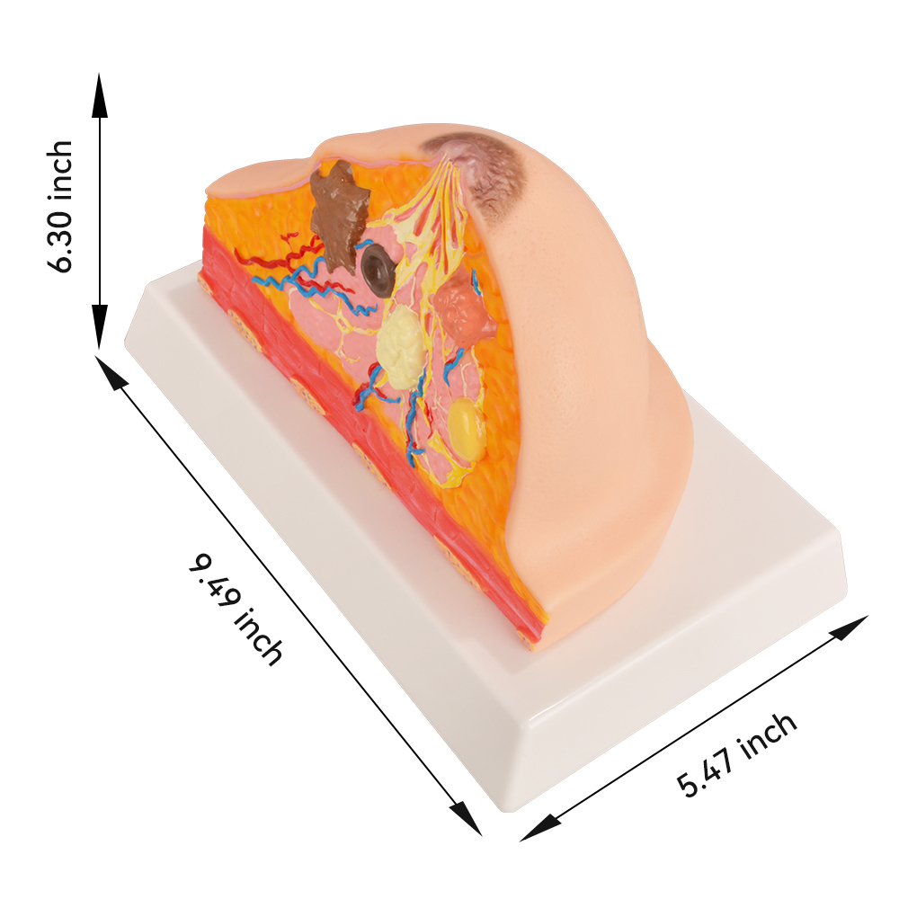 The Size Info of Educational Breast Anatomy & Pathology Model
