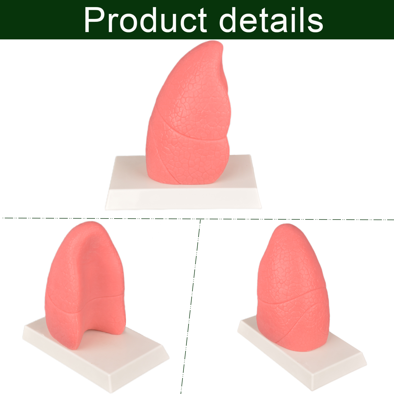 Normal Lung vs Smoker Lung Anatomy Model