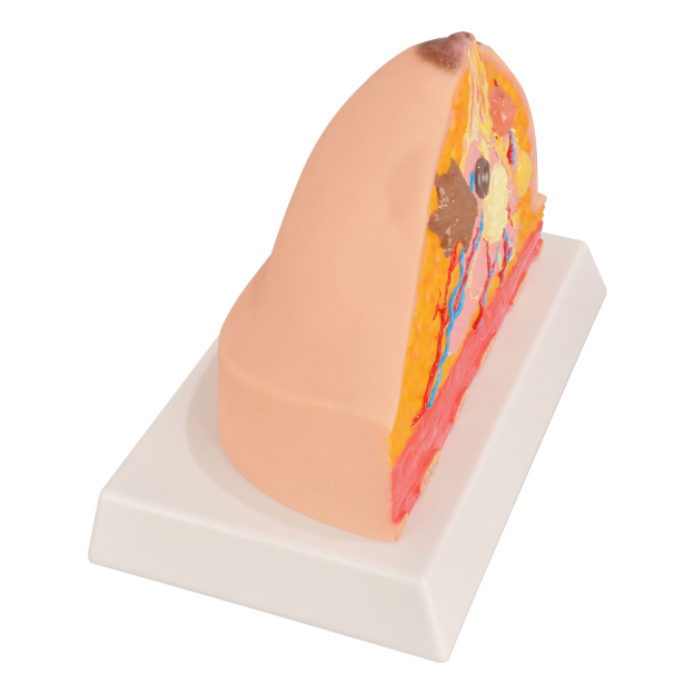 Educational Breast Model For Women’s Health Awareness
