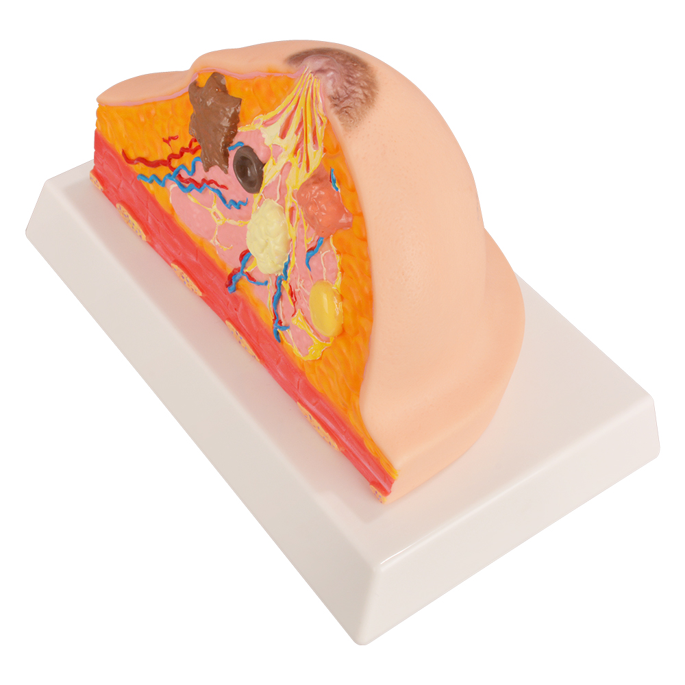Breast Anatomy Model With Pathological Features For Education
