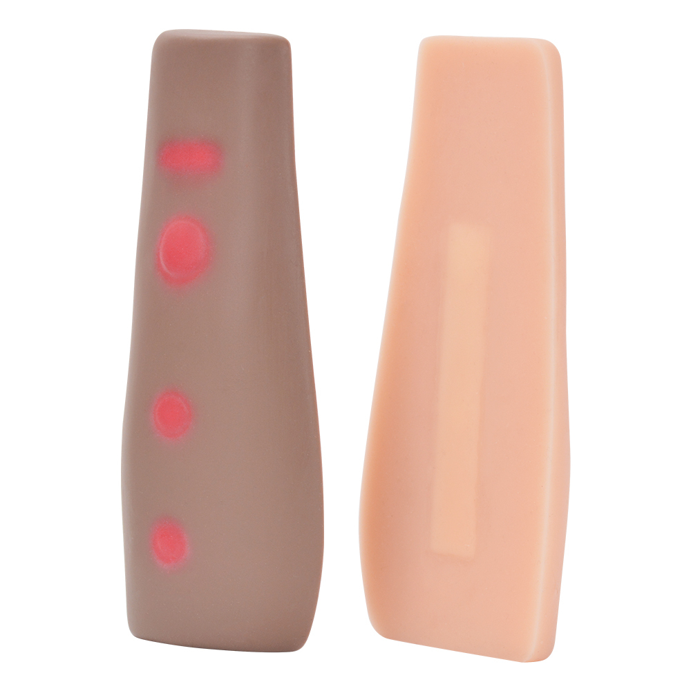 Tuberculosis Skin Test Simulator In Two Skin Tones