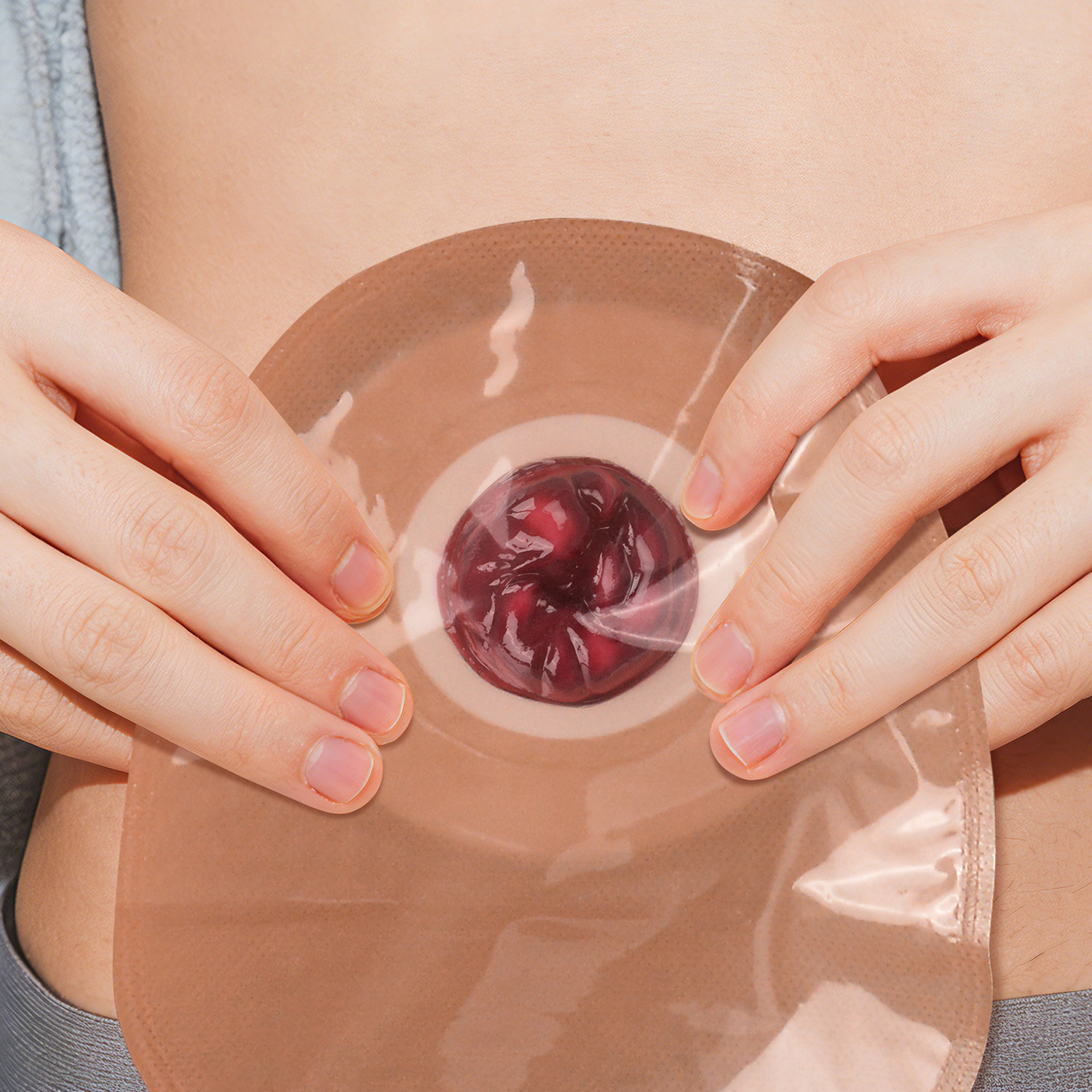 Abnormal Ostomy Care Training Model