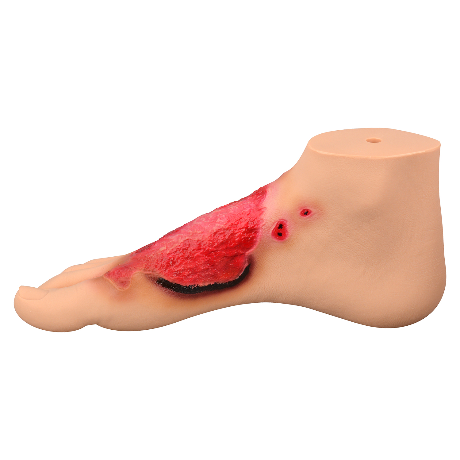 Chemical Burn Foot Teaching Model