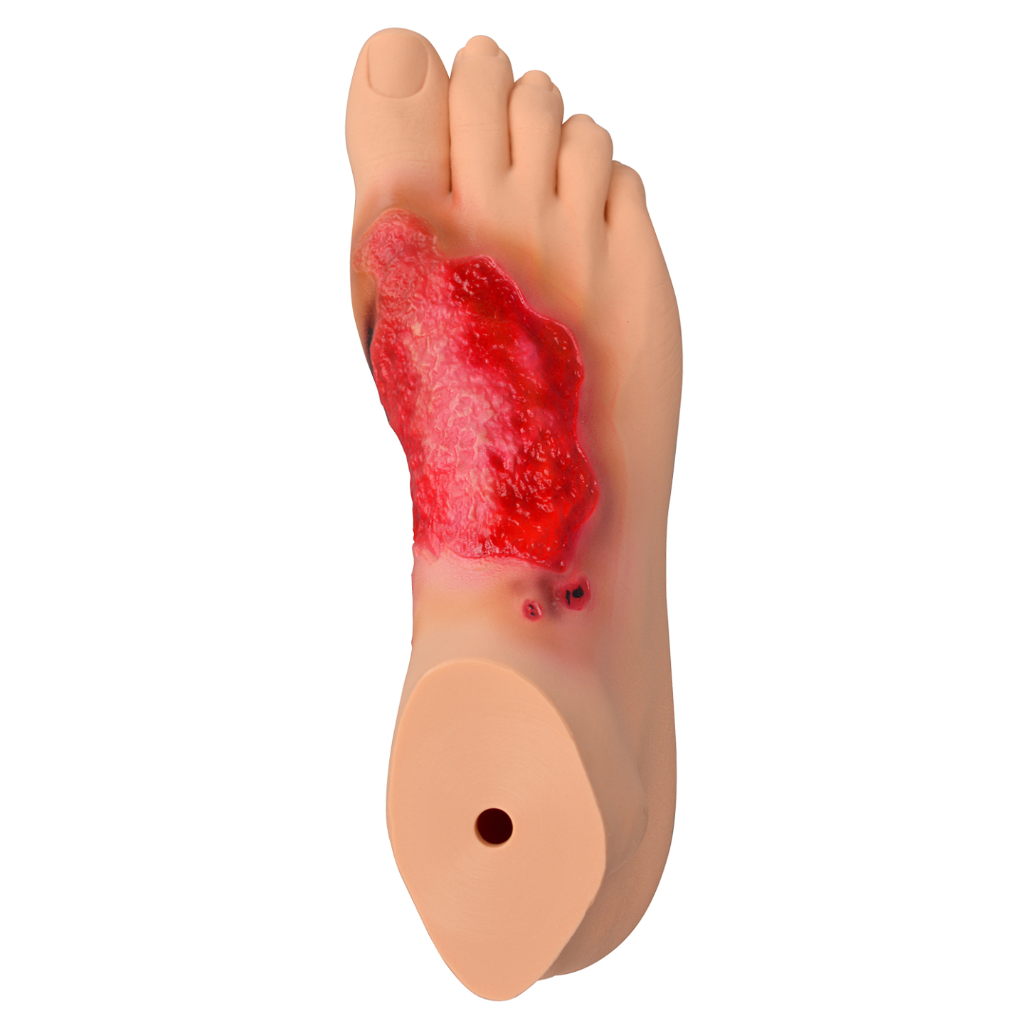 Chemical Burn Foot Teaching Model