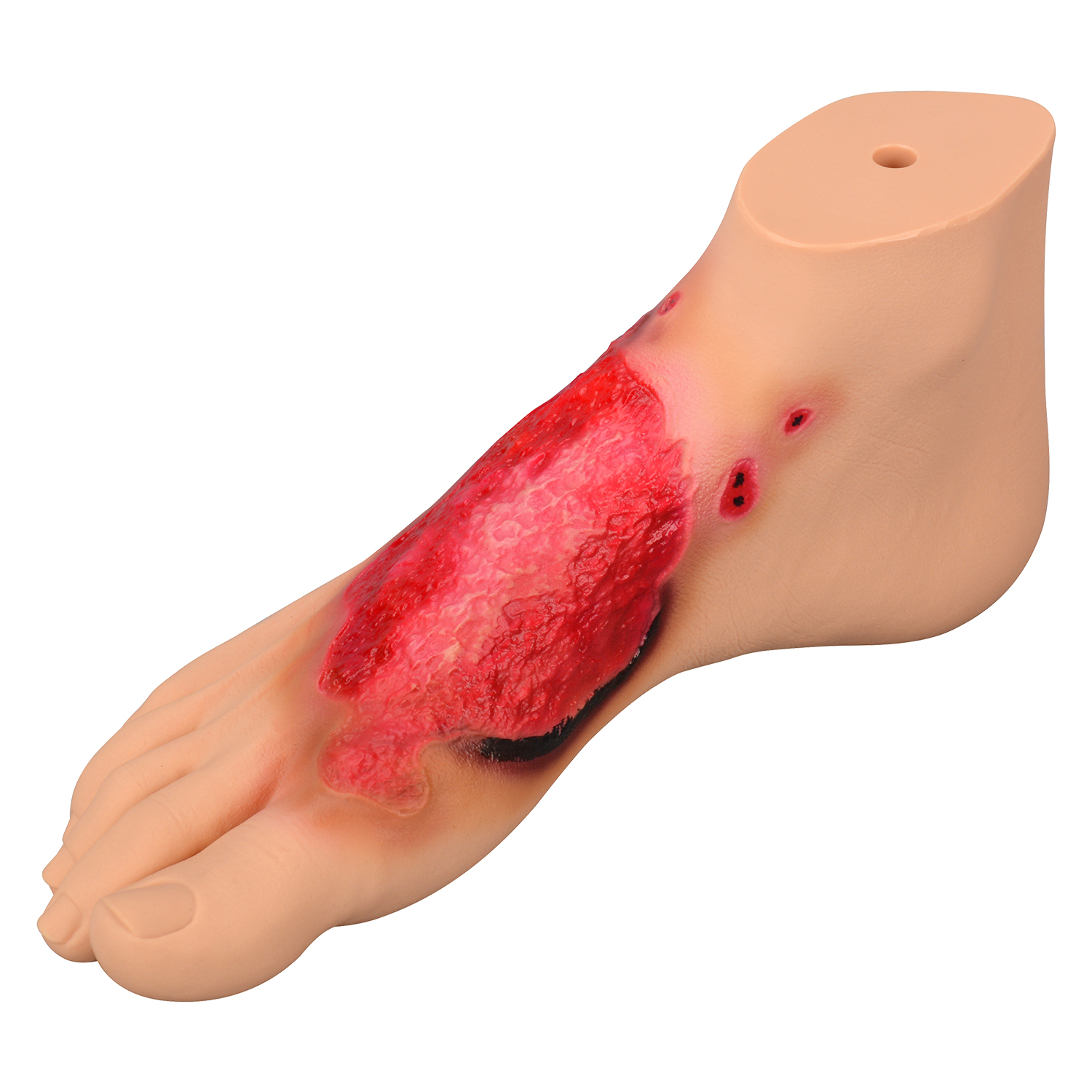 Chemical Burn Foot Teaching Model