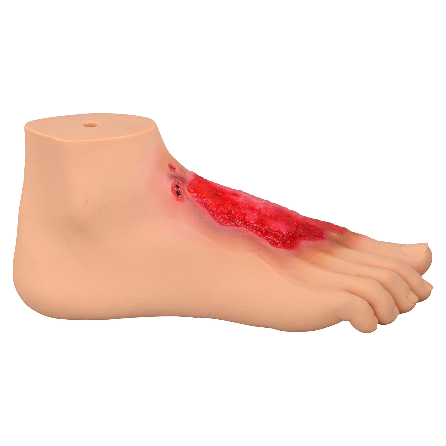 Chemical Burn Foot Teaching Model