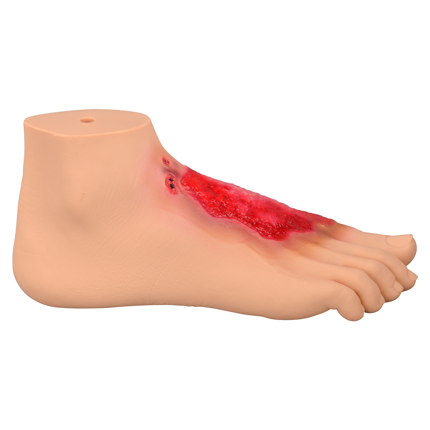 Chemical Burn Foot Teaching Model