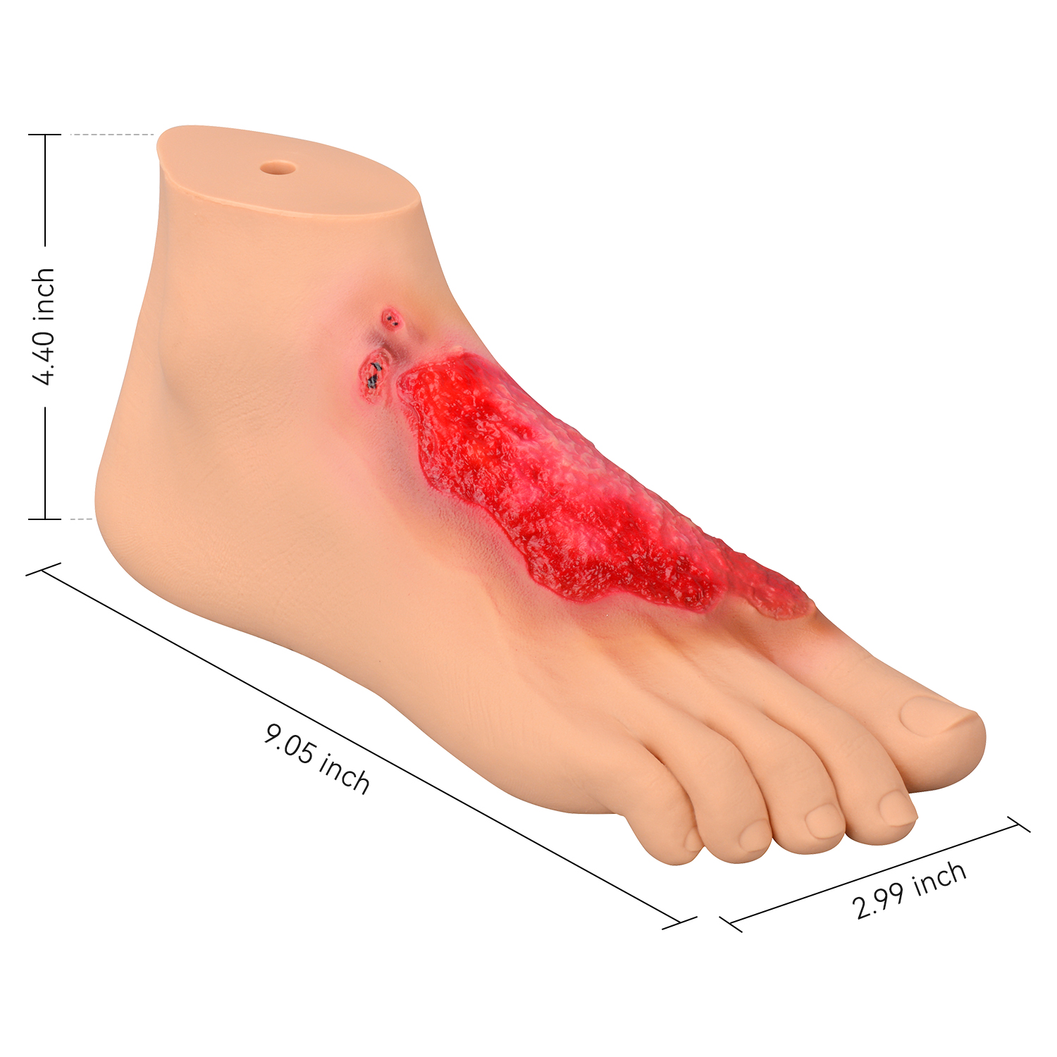 Chemical Burn Foot Teaching Model