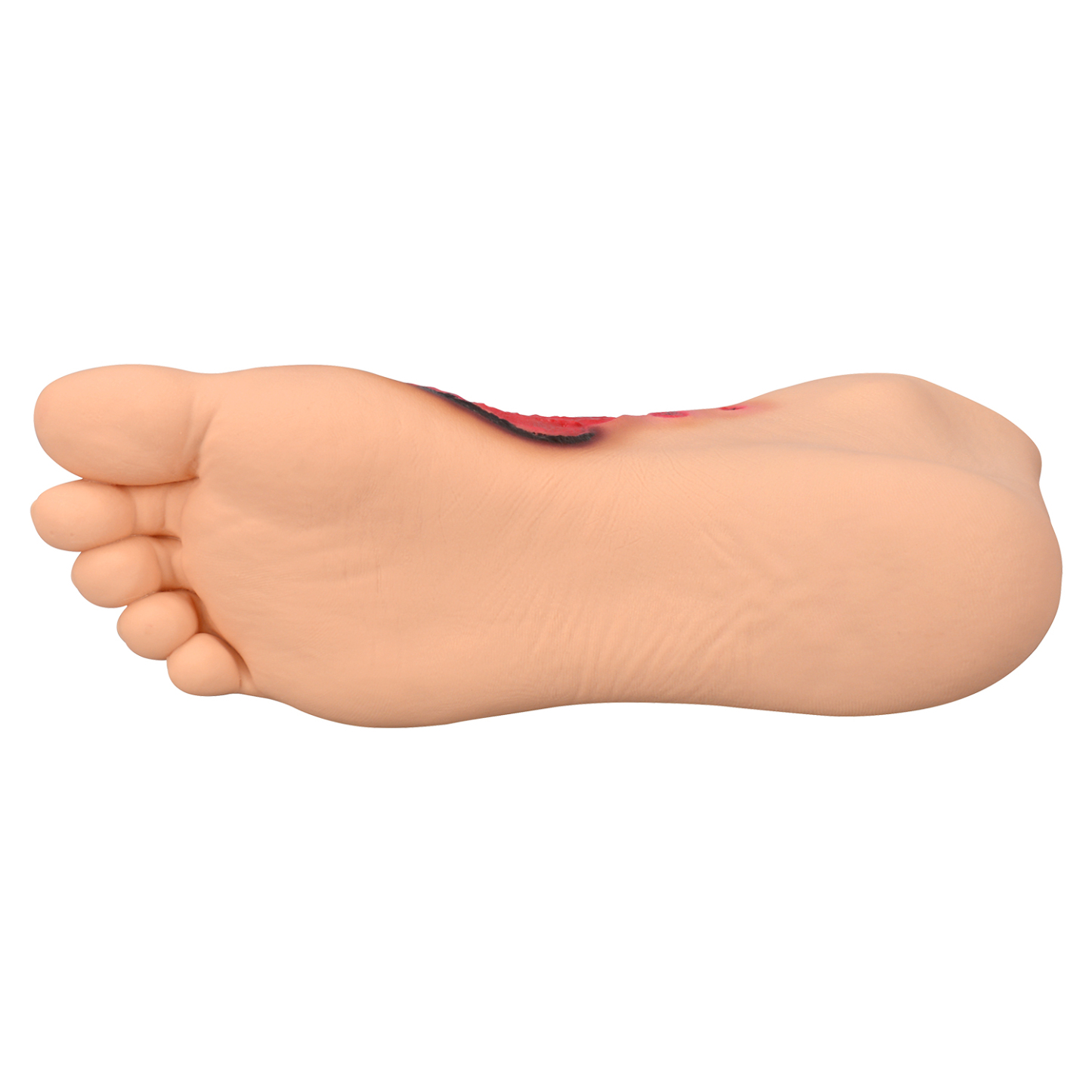 Chemical Burn Foot Teaching Model