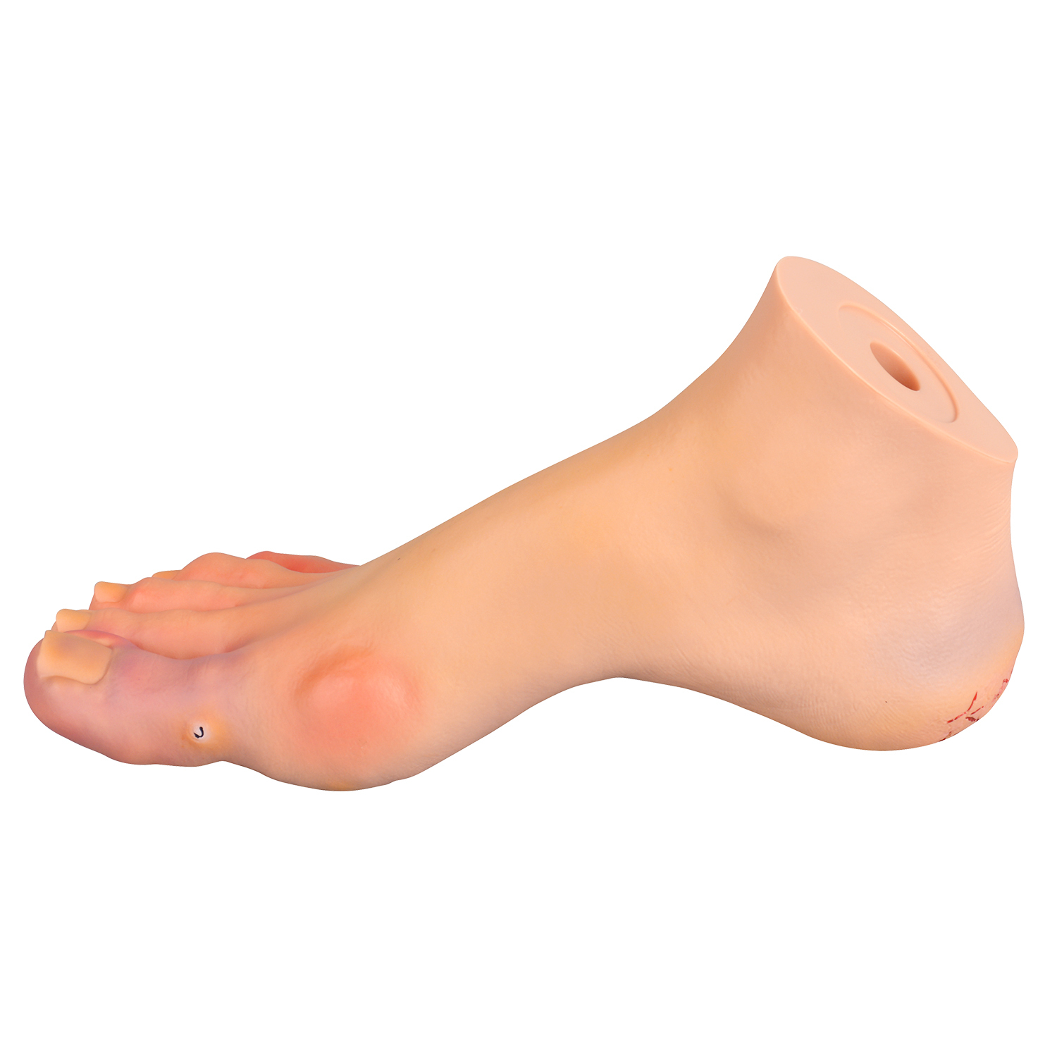 Foot Pathology Model for Podiatry Education