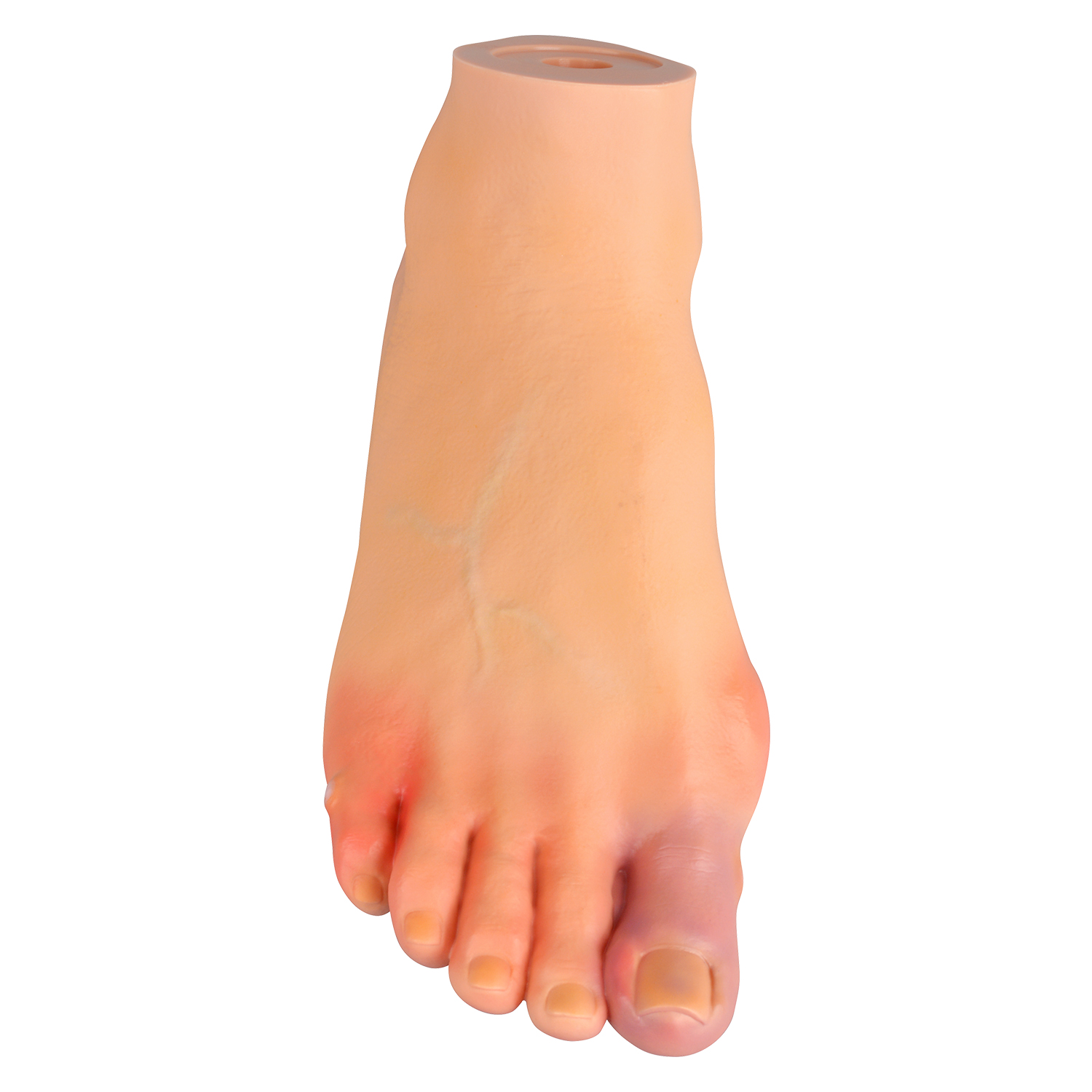 Foot Pathology Model for Podiatry Education