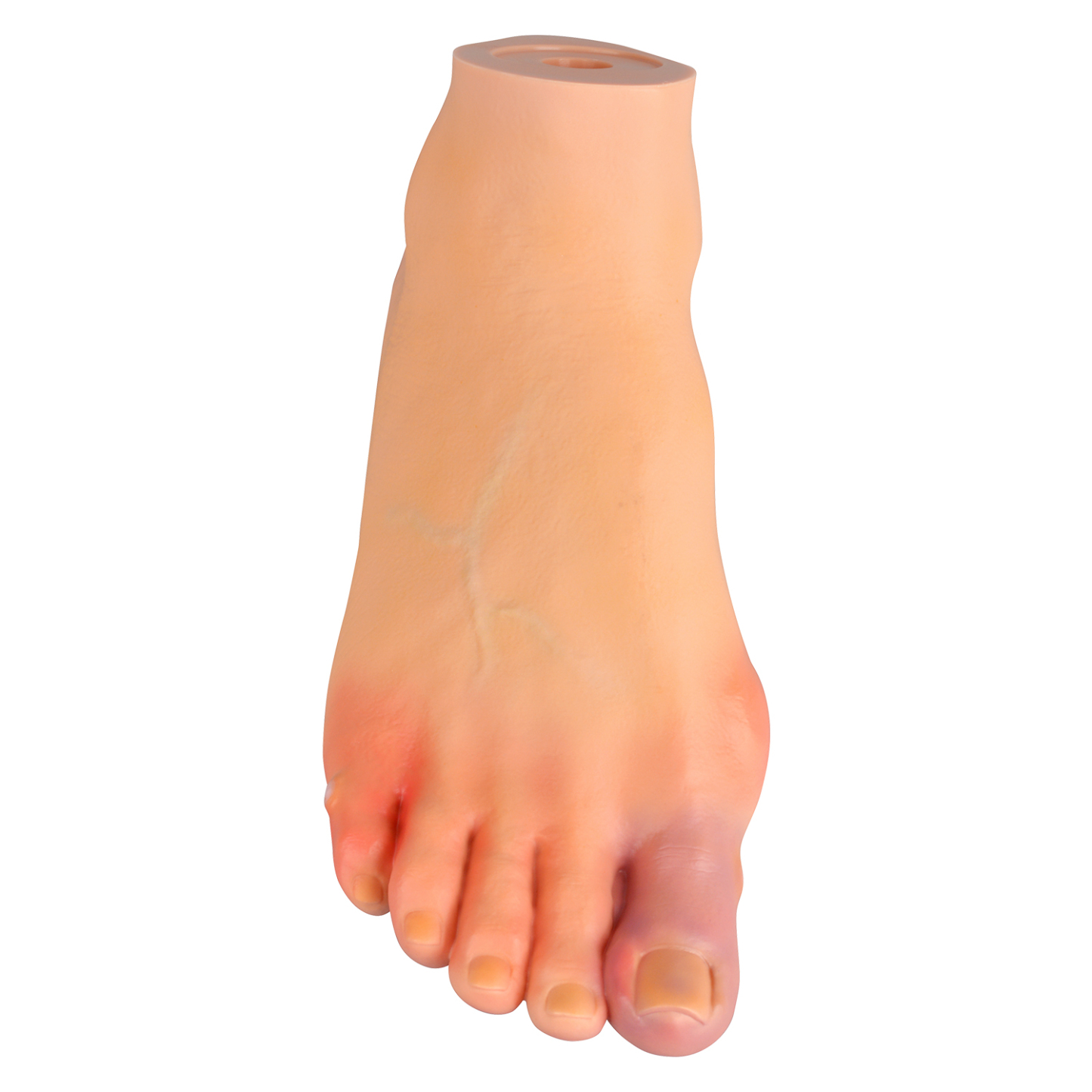 Foot Pathology Model for Podiatry Education