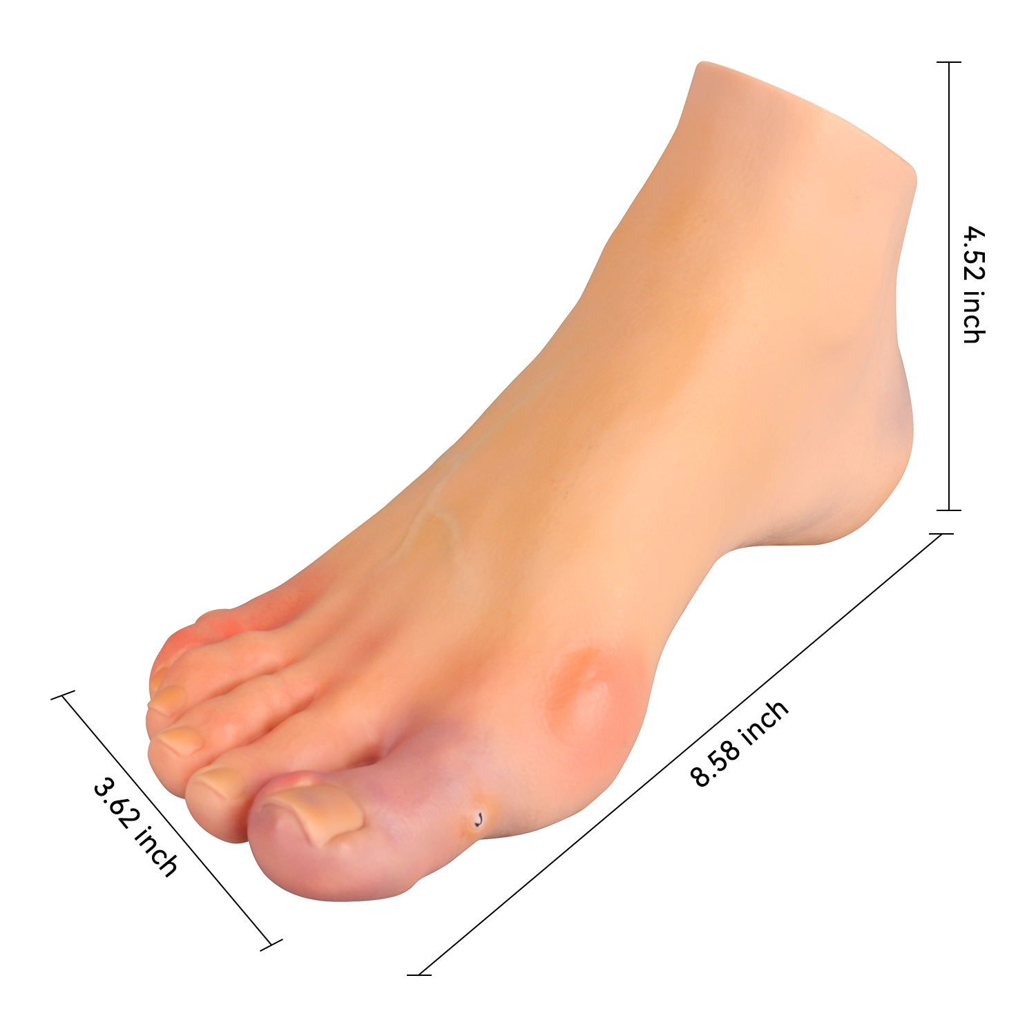 Foot Pathology Model for Podiatry Education