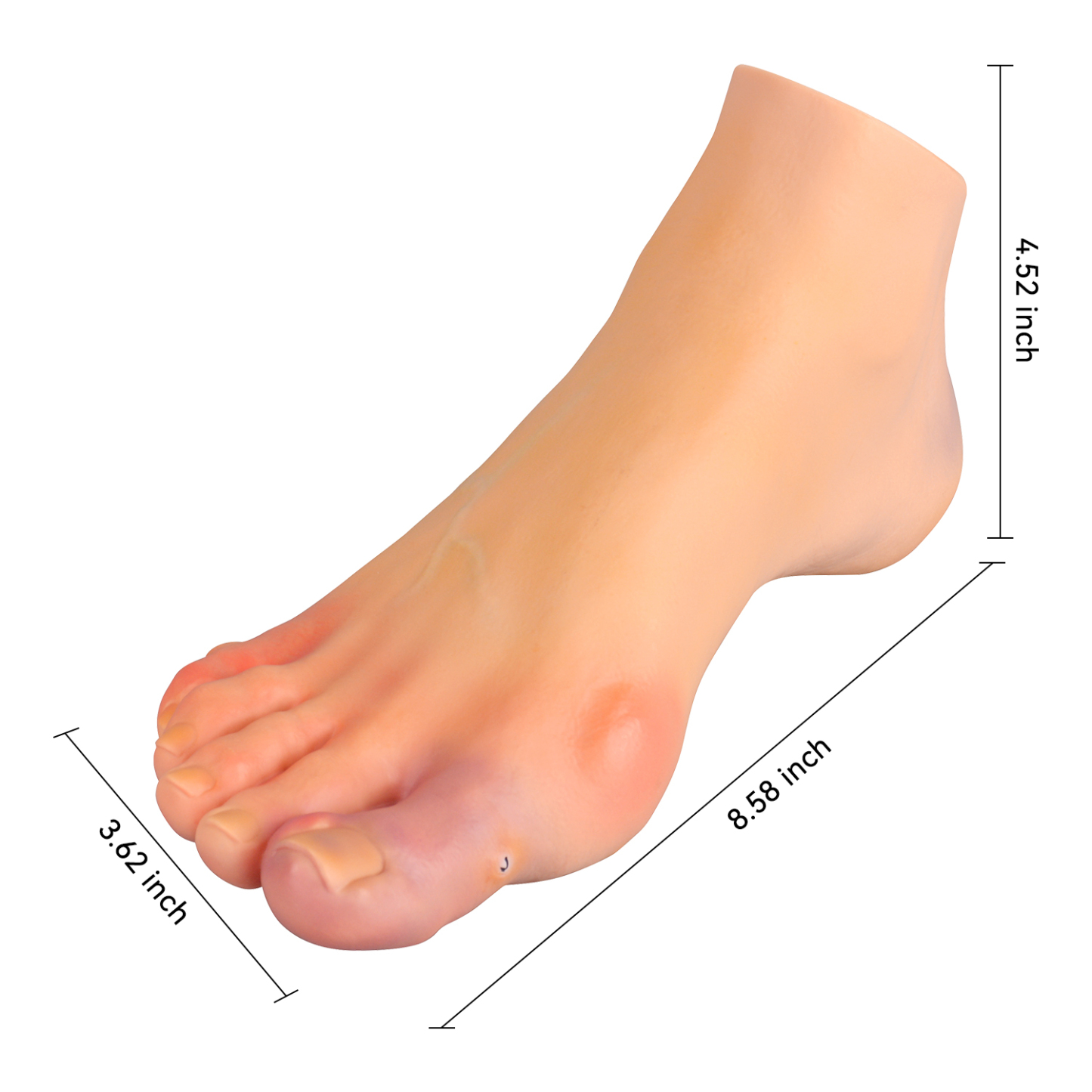 Foot Pathology Model for Podiatry Education