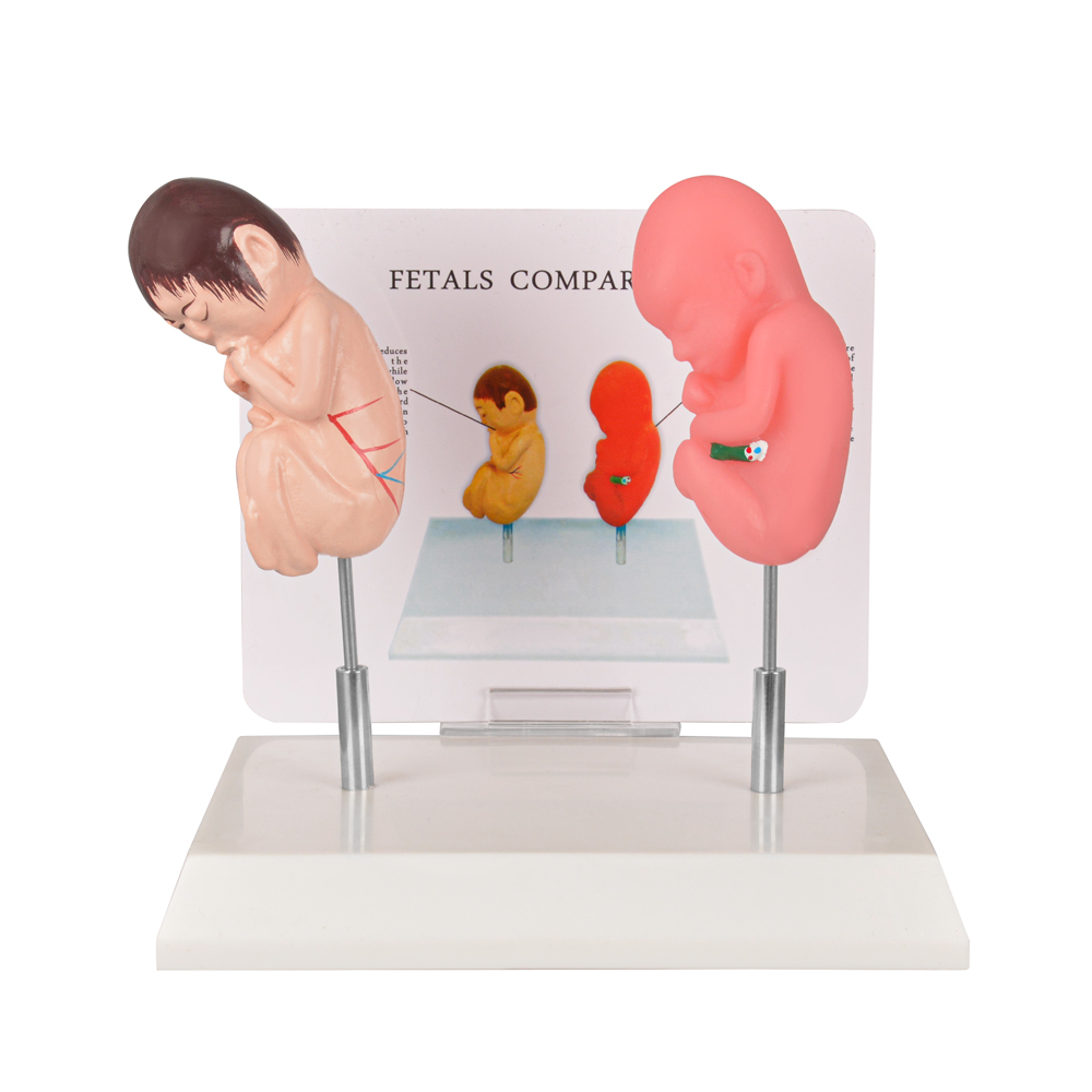 Smoking Fetus Model vs Healthy Fetus Comparison Model