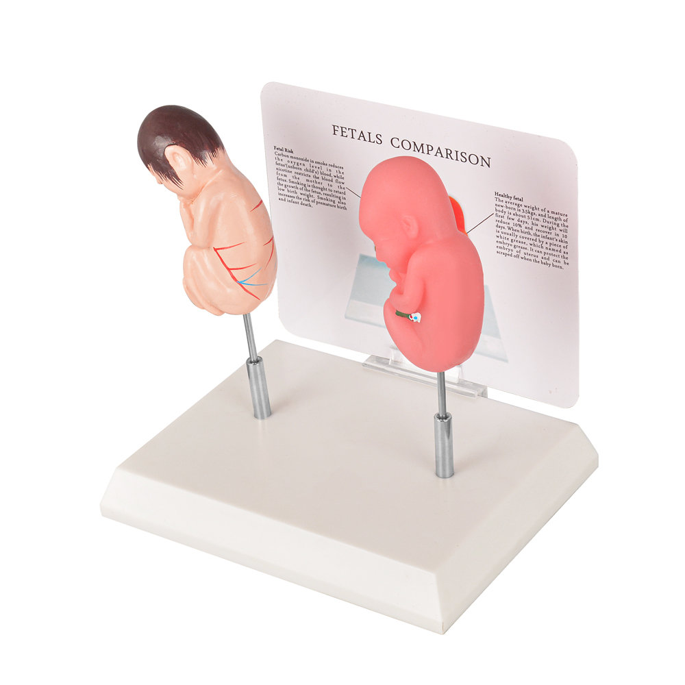 Smoking Fetus Model vs Healthy Fetus Education Model Include Base