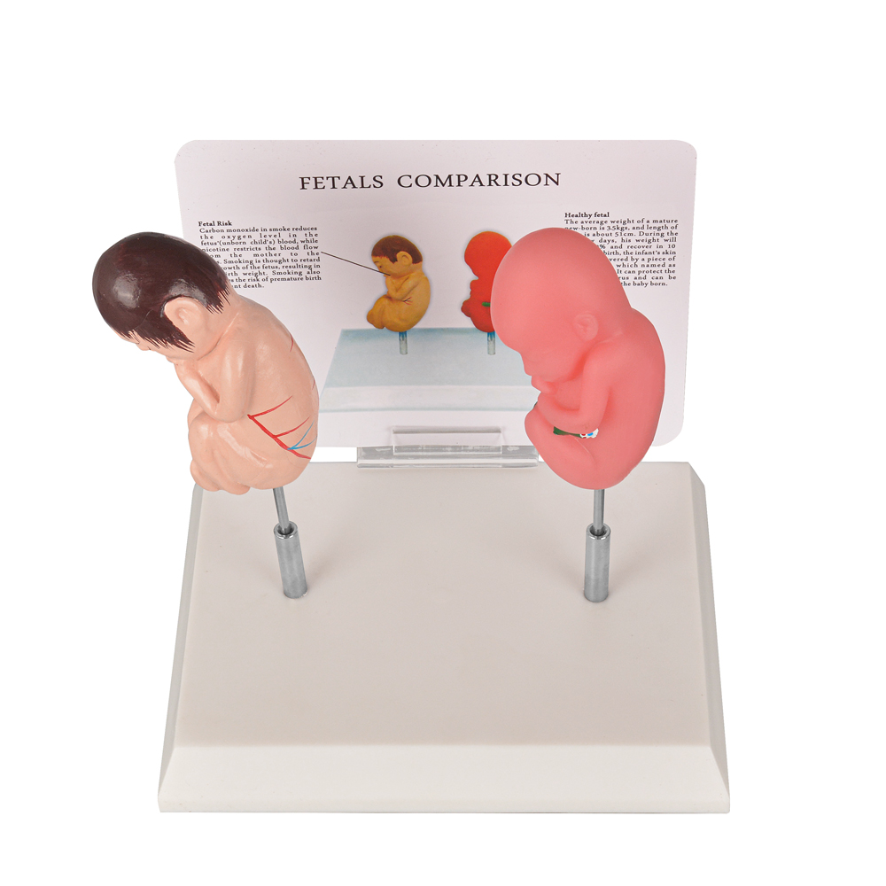Smoking Fetus Model vs Healthy Fetus Education Model