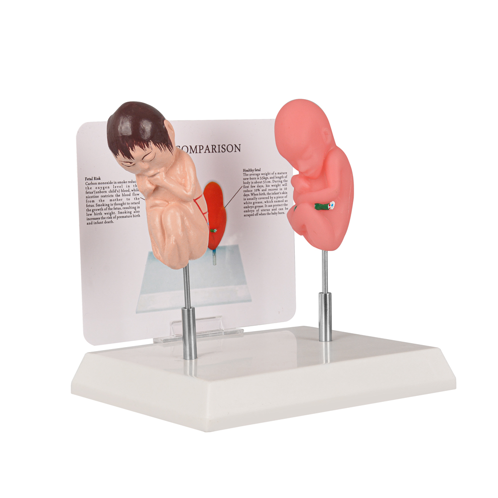 Smoking Effect Fetal Education Model