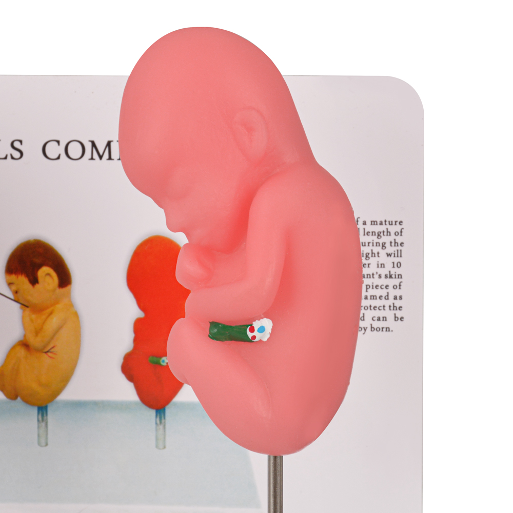 Effects of Smoking Fetus Model