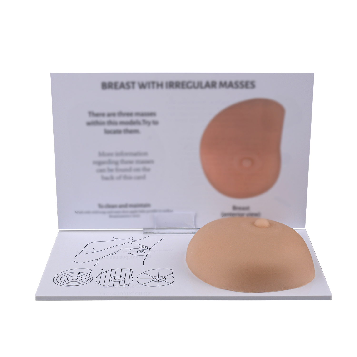 3 Embedded Palpable Lumps in BSE Model 