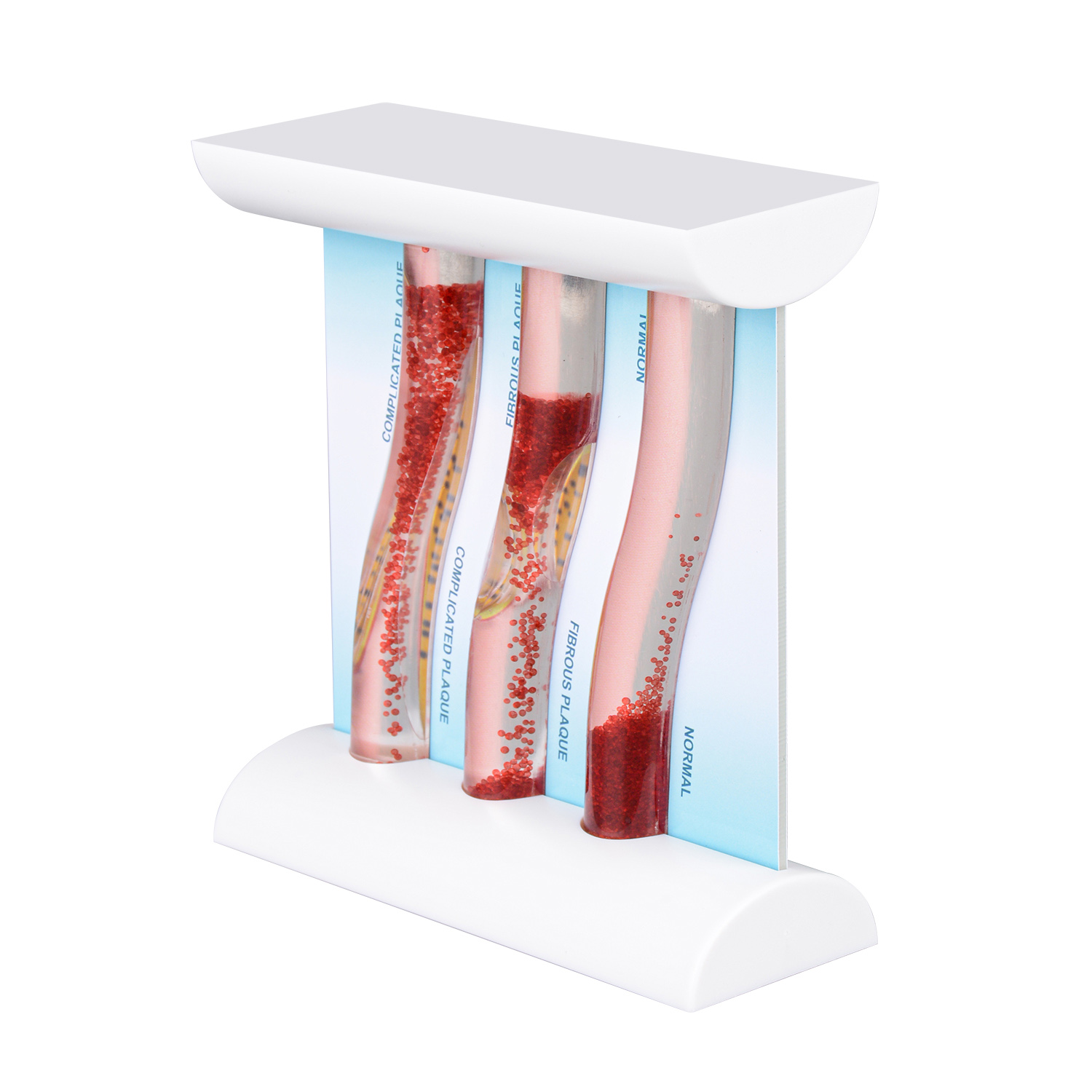 3-Vessel Blood Vessel Model, Normal vs Blocked Arteries from High LDL